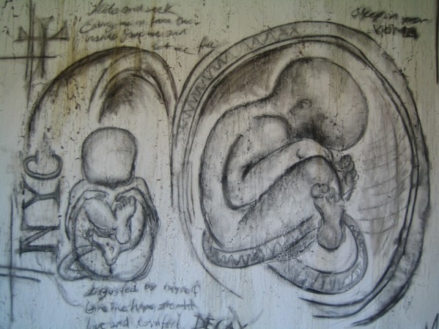 NYC Foetus