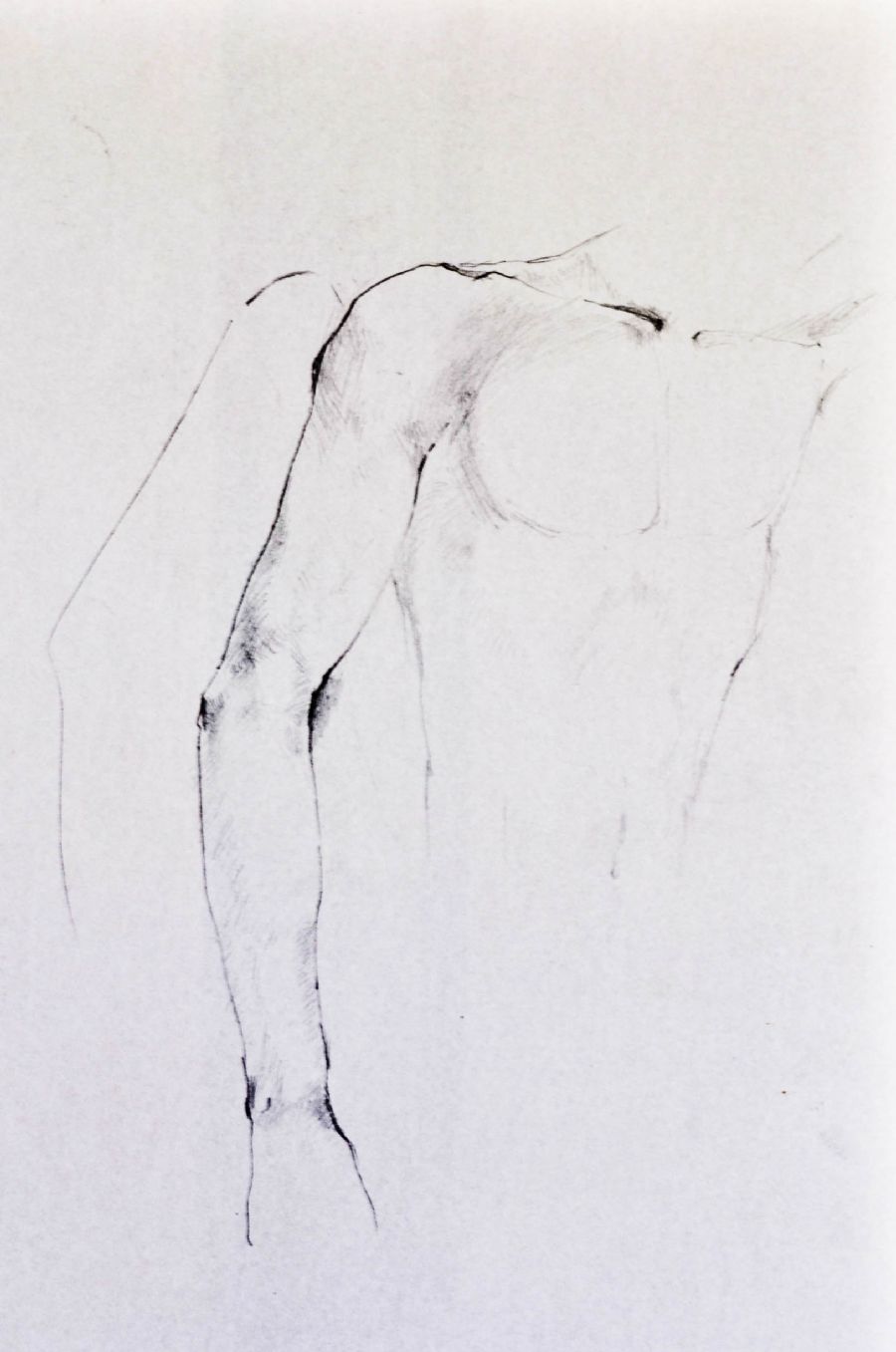 Arm