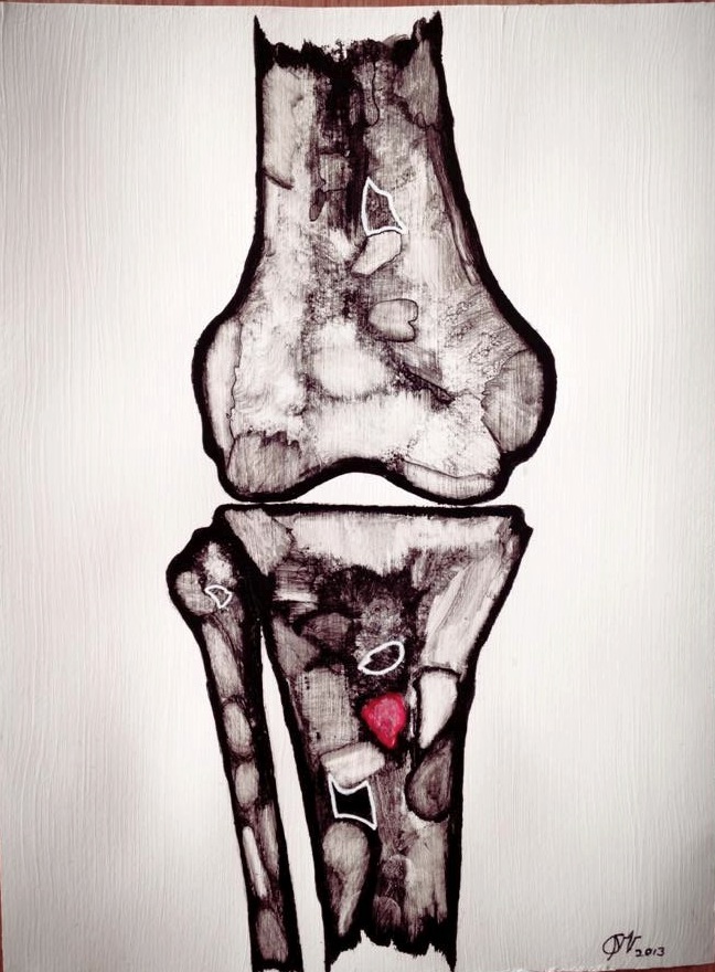Knee