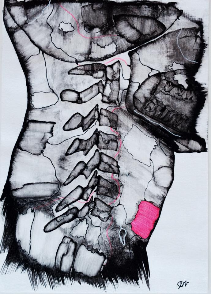The neck on X-ray