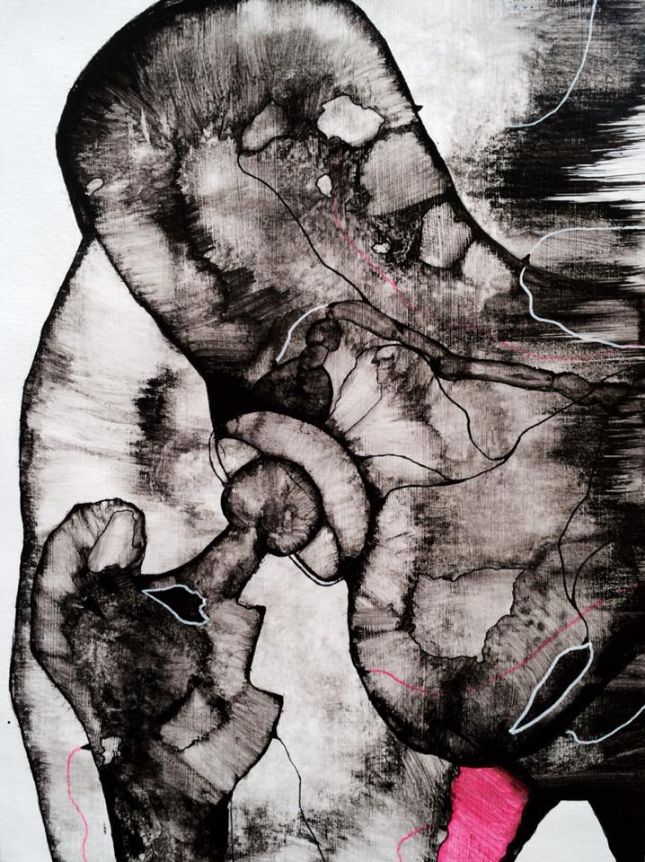 Right hip X-ray