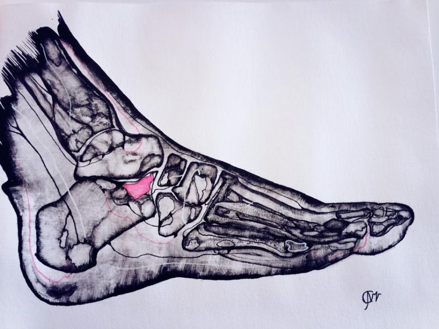 Foot on x Ray