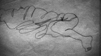 Drøm