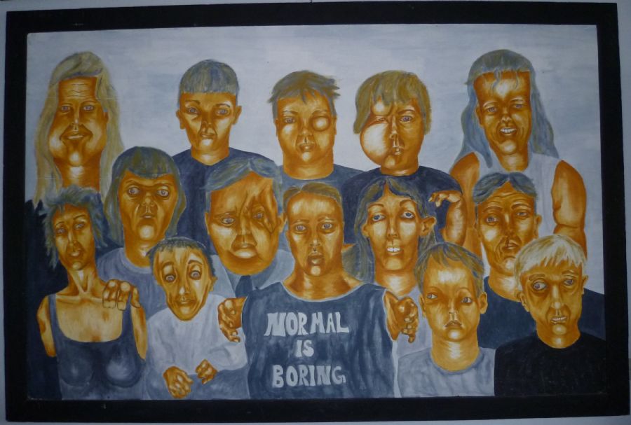 "Normal Is Boring"