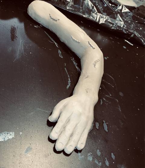 “The arm with many bite marks”
